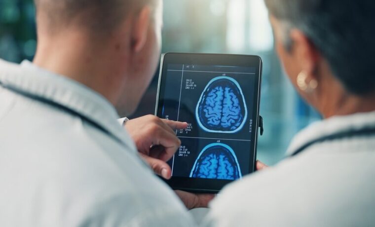 Fibrillazione atriale e declino cognitivo